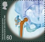 Medical Breakthroughs 60p Stamp (2010) Total hip replacement operation pioneered by Sir John Charnley 1962