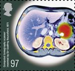 Medical Breakthroughs 97p Stamp (2010) Computed tomography scanner invented by Sir Godfrey Hounsfield 1971