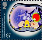 Medical Breakthroughs 97p Stamp (2010) Computed tomography scanner invented by Sir Godfrey Hounsfield 1971